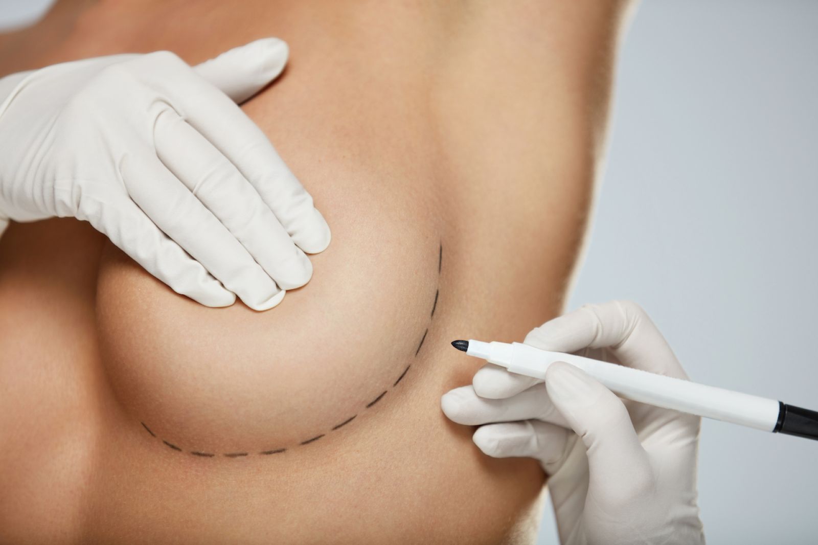 Breast Aesthetic Surgery & Breast Oncology