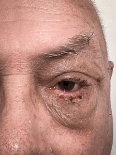 Photo of a patient after surgery