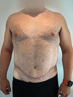 Photo of a patient before surgery