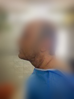 Photo of a patient before surgery