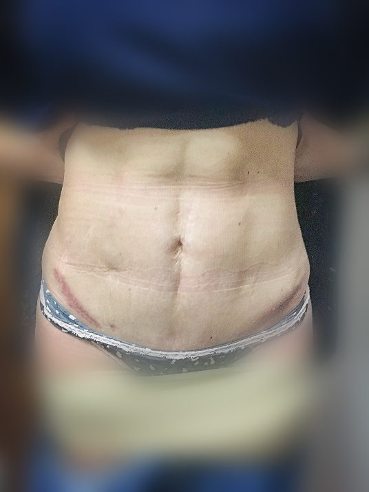 Photo of a patient before surgery