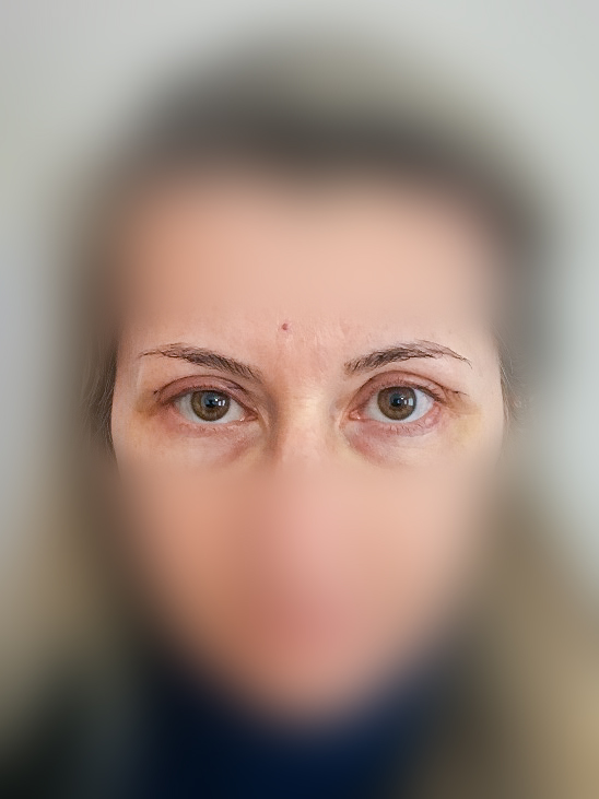 Photo of a patient before surgery