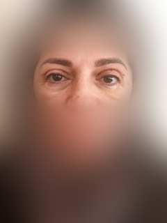 Photo of a patient after surgery